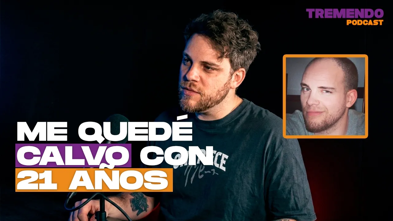Me quedé CALVO con 21… y esto me cambió la vida – Los consejos de Michael
